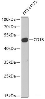 Anti-CD1B