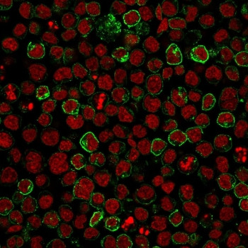 Anti-CD10 / Neprilysin, clone MME/1620