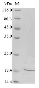 Disco-interacting protein 2 homolog A (DIP2A), partial, human, recombinant