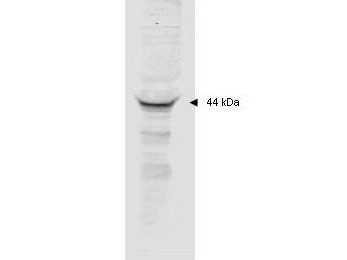 Anti-MAPKAP Kinase 2 (Mitogen-activated Protein Kinase Activated Protein Kinase 2)