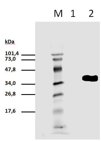 Anti-phospho-CD3 zeta (Tyr111), clone EM-55