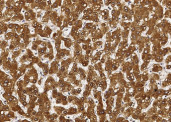 Anti-SULT1A1 Monoclonal Recombinant Antibody