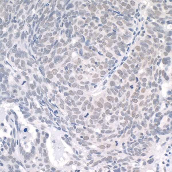 Anti-USP1 (IHC)