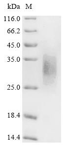 Parathyroid hormone/parathyroid hormone-related peptide receptor (PTH1R), partial, recombinant Macac