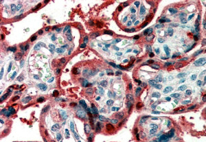 Anti-Ghrelin preproprotein, C-terminal