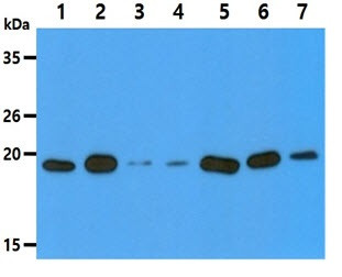 Anti-DUSP3, clone 9E6