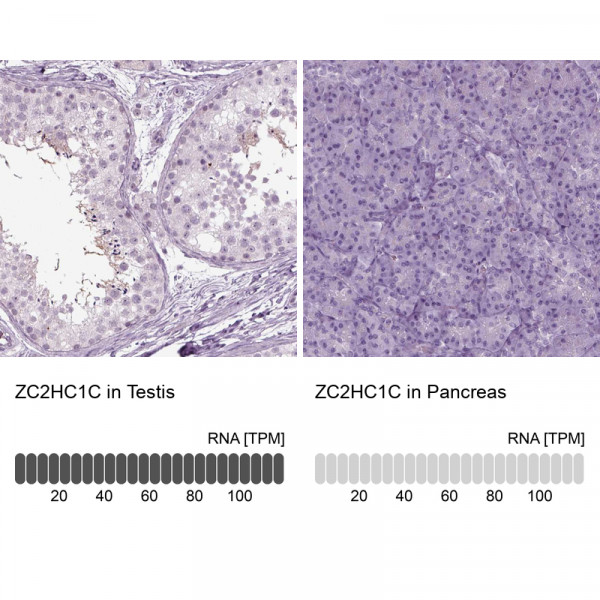 Anti-ZC2HC1C