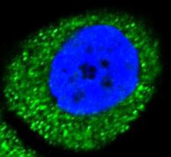 Anti-PI3 Kinase Class III