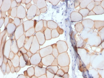 Anti-Dystrophin / DMD, clone DMD/3241