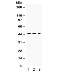 Anti-Neuroserpin / SERPINI1