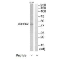 Anti-ZDHHC2
