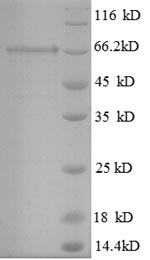 Glutamate decarboxylase 2 (Gad2), mouse, recombinant