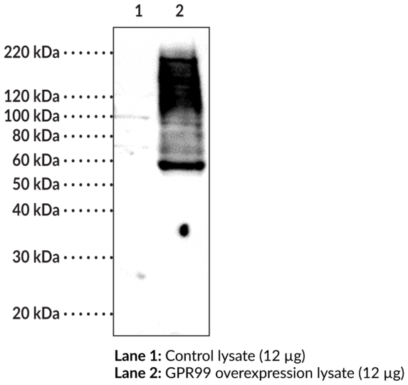 Anti-GPR99 (C-Term)