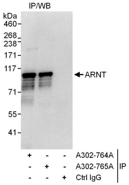 Anti-ARNT