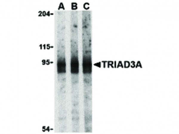 Anti-TRIAD3A