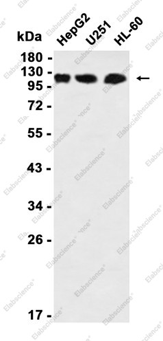 Anti-Recombinant Daxx, clone C112747