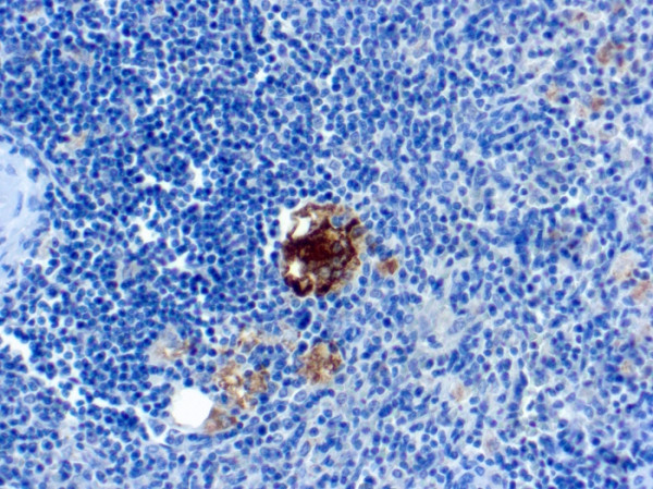 Anti-TRAcP (Tartrate-Resistant Acid Phosphatase) (Hairy Cell Leukemia Marker), clone SPM601