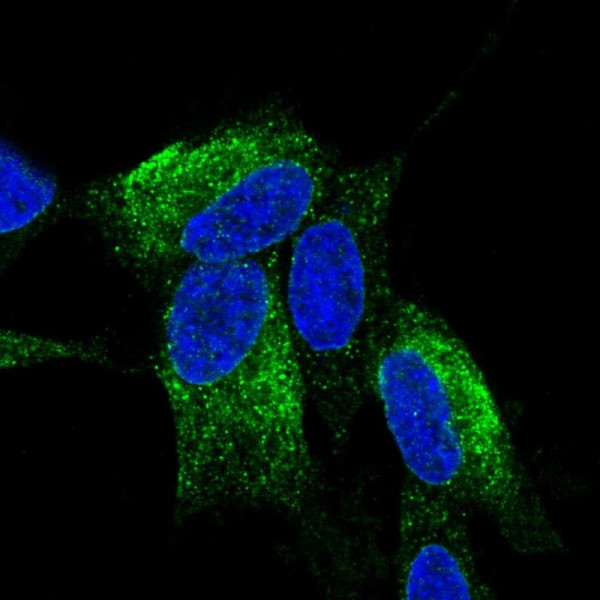 Anti-ZNF354C