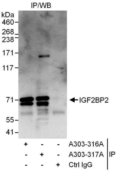 Anti-IGF2BP2