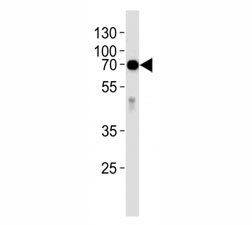 Anti-Alkaline Phosphatase