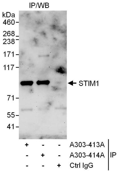 Anti-STIM1