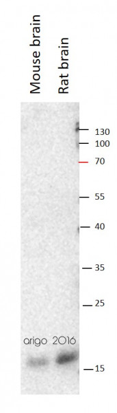Anti-alpha Synuclein