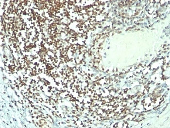 Anti-Nucleolin Cocktail, clone 364-5 + NCL/902