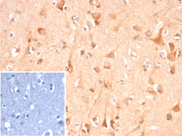 Anti-ADCY8 (Adenylate Cyclase 8), clone ADCY8/7341
