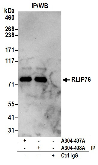 Anti-RLIP76