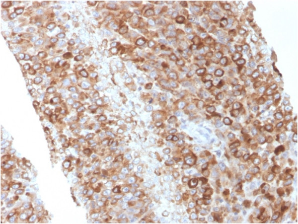 Anti-CD63 (Late Endosomes Marker), clone LAMP3/2881