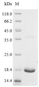Platelet glycoprotein Ib beta chain (GP1BB), partial, human, recombinant