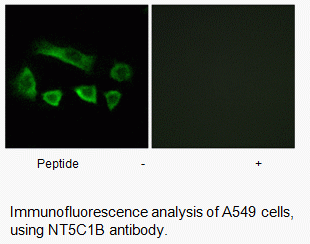 Anti-NT5C1B