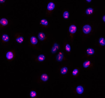 Anti-RSL24D1 / Ribosomal L24 domain-containing protein 1