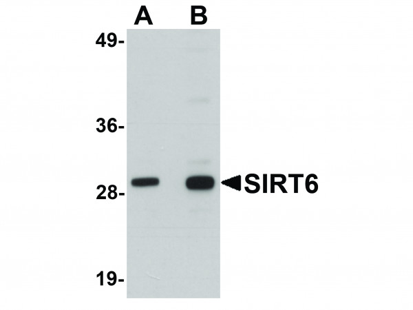 Anti-SIRT6