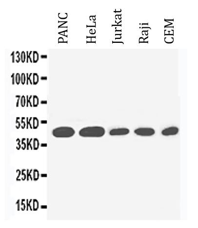 Anti-IL2 Receptor gamma