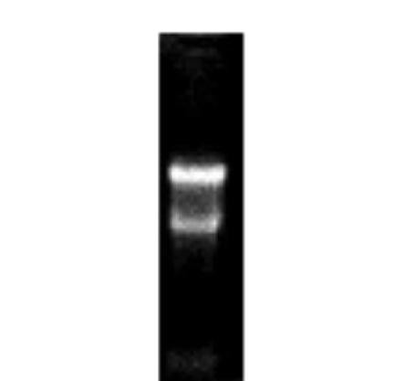 Tissue, Total RNA, Rat Adult Normal, Skeletal Muscle