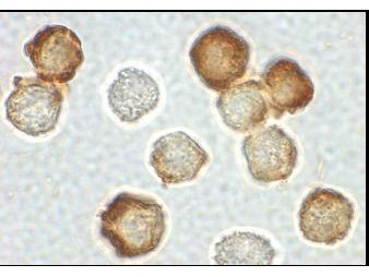 Anti-IRAK2 (IL-1 Receptor-associated Kinase 2)
