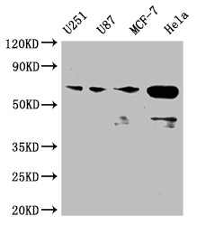 Anti-STK3 Recombinant Monoclonal, clone 3C3