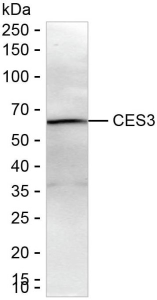 Anti-CES3