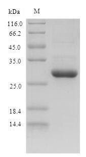 Protein S100-A9 (S100a9), mouse, recombinant