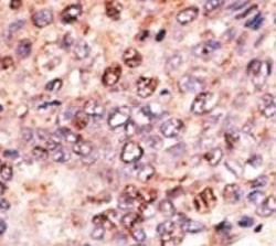 Anti-ABCB7