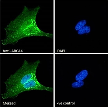 Anti-ABCA4 / ATP-binding cassette sub-family A member 4