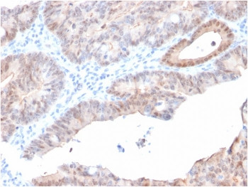 Anti-ARK1C2 / Aldo-keto Reductase Family 1 Member C2, clone CPTC-AKR1C2-1
