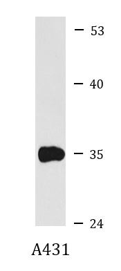 Anti-CYB5R3