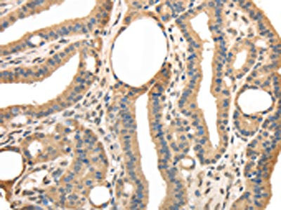 Anti-TRIB3
