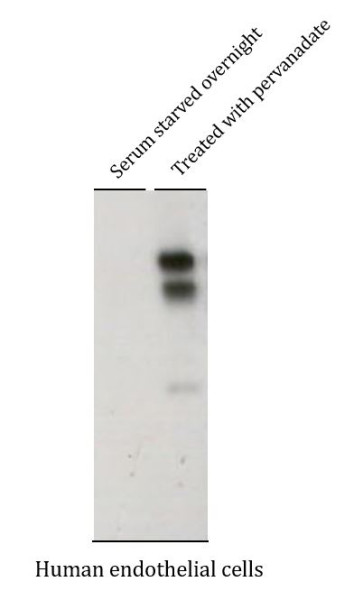 Anti-phospho-BCAR1 / p130 Cas (Tyr762)