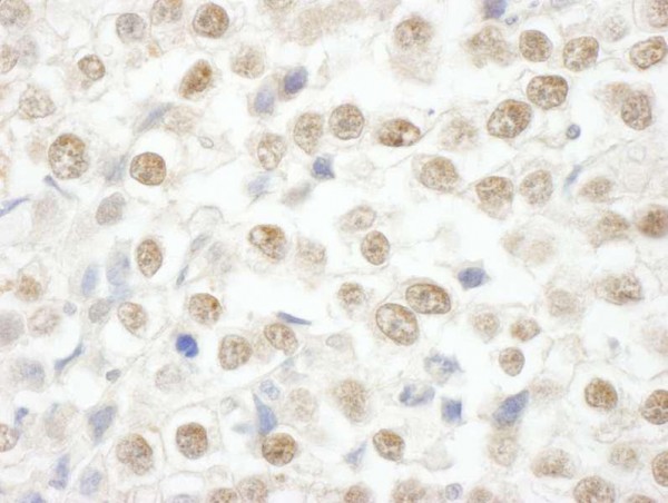 Anti-ARID2 (IHC)