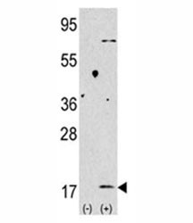 Anti-MAP1LC3B Antibody (LC3 II)