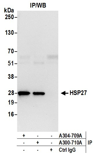 Anti-HSP27