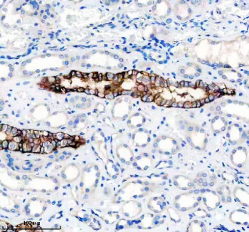 Anti-L1CAM / NCAM-L1 / CD171, clone AAFD-12